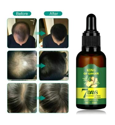 King Of Ginger: Revitaliza y Fortalece desde la raíz en solo 7 días